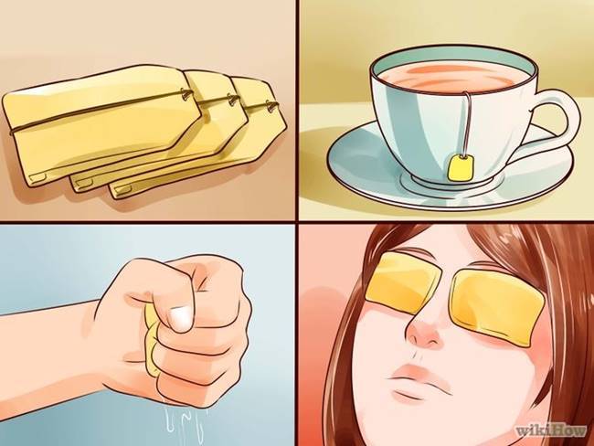 Effective Home Remedies To Soothe Sore Eyes