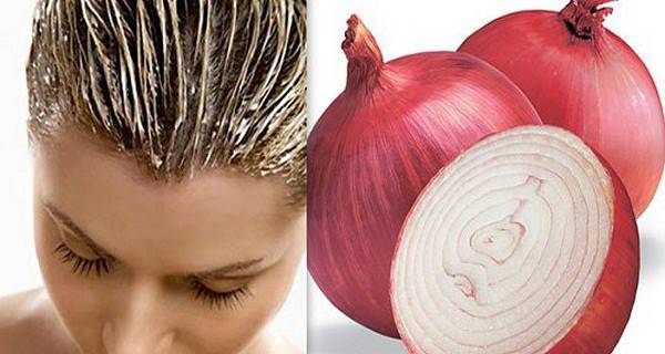 Creative Uses of Onion as Natural Home Remedies --> help your hair grow 2 times faster