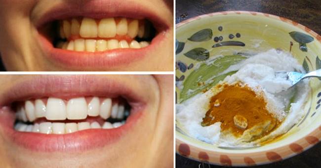 Creative Ideas - How To Whiten Your Teeth Using Turmeric