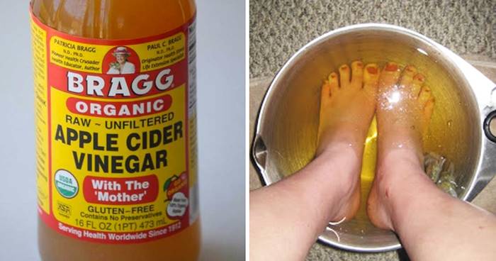 16 Creative Uses of Apple Cider Vinegar For Your Health And Beauty