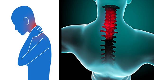 Health Tips - How to Relieve Stiff Neck Naturally in 90 Seconds
